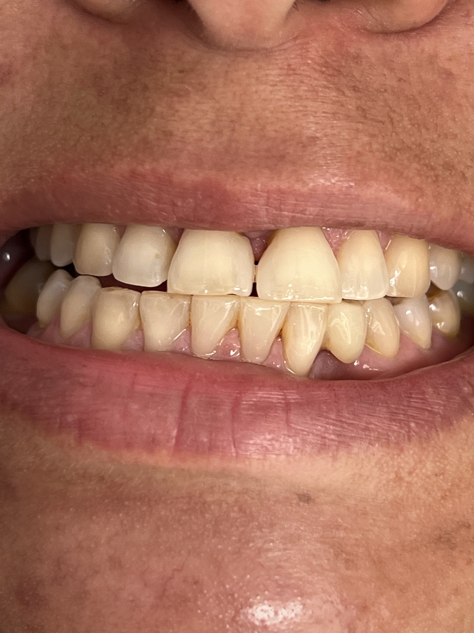 Vista intraoral para análisis de forma, color y función